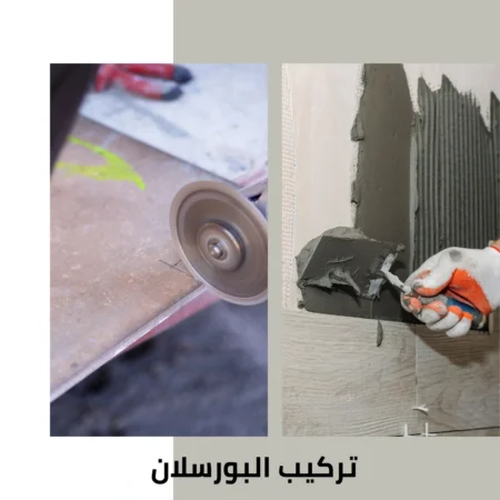تركيب البورسلان